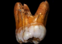 کشف دندان ۱۱۰ هزار ساله انسان/ عکس